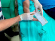 PCPR identifica pacientes e colabora no serviço de doação de órgãos do Estado